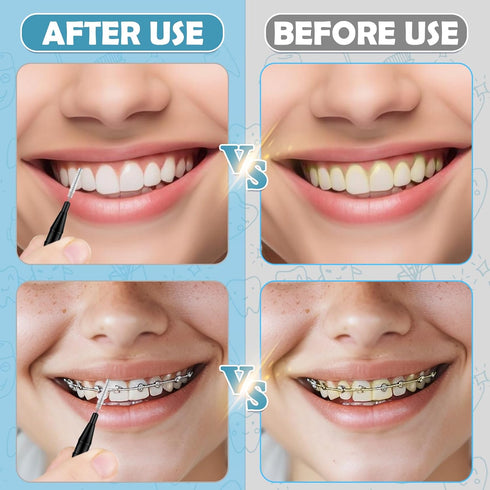 120 Pieces Braces Flossers for Cleaner Interdental Brushes Between Teeth, Toothpick Dental Tooth Flossing with Soft Bristles 360° Bendable Oral De...